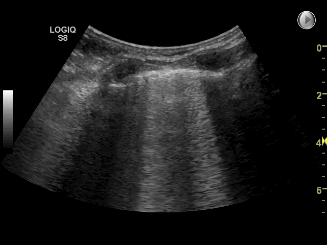 EEU case image missing